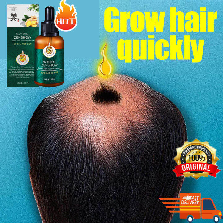 Hair Growth Serum Hair Growth Serum Oil White hair to black hair 30ml Fast Promotes Hair Growth