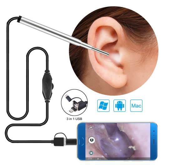 Camera nội soi y tế, camera nội soi tai, mũi, họng - ảnh sản phẩm 1