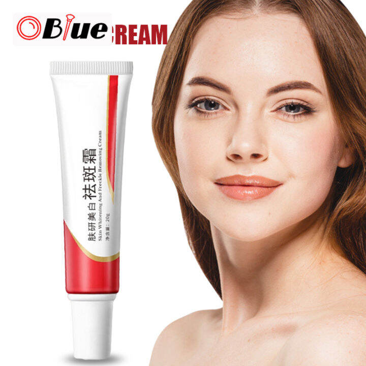 OBlue Skin Cream Strong Effect Whitening Freckle Cream Remove Melasma ...