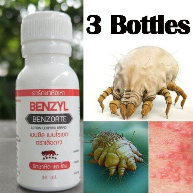 3 Bottle SCABIES TREATMENT LOTION MITE & LICE effective 30ml Lazada.co.th