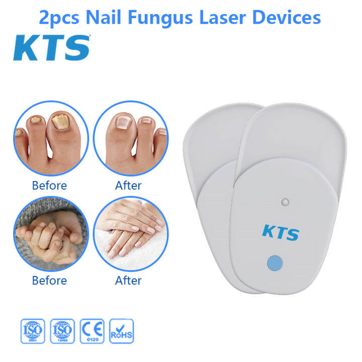 KTS original Onychomycosis toenail fungus treatment Laser Nail Fungus