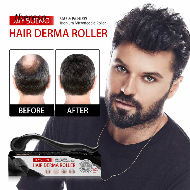 Micro Needle Roller Derma Roller Dermaroller Titanium Hair Regrowth Beard Growth Anti Hair Loss