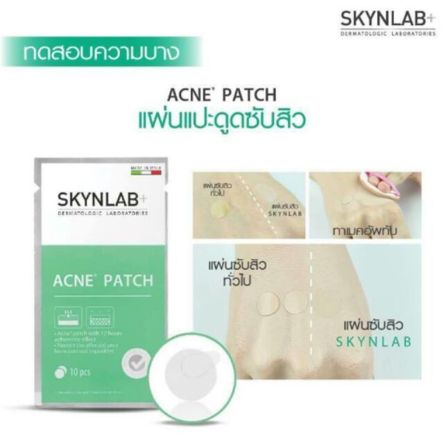 skynlab-สกินแล็บ-แอคเน่-แพทช์-แผ่นแปะดูดสิว-10ชิ้น-แผ่น-แผ่นแปะสิว-แผ่นซับสิว-สิว-ปกปิดสิว-แต้มสิว-acne-patch