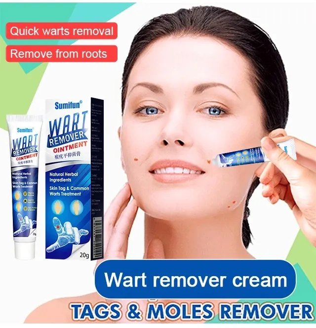 Super Cheap Corn Treatment Warts Remover Ointment Lazada PH