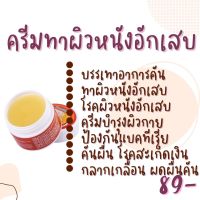 Sumifun ครีมทาผิวหนังอักเสบ โรคผิวหนังอักเสบ ครีมบํารุงผิวกาย ป้องกันแบคทีเรีย คันผื่น โรคสะเก็ดเงิน 10 กรัม