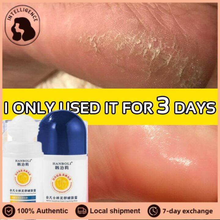 🎀🎀IE Vaseline Anti Cracking Cream Vaseline Foot Blam Petroleum Jelly Stick Special Moisturizing