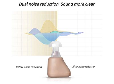 ZZOOI 2020 Rechargeable Hearing Aids Sound Amplifier Invisible Hearing Aid Ear Hearing Amplifier Aid Mini Hearing Aid for Deaf/Elderly