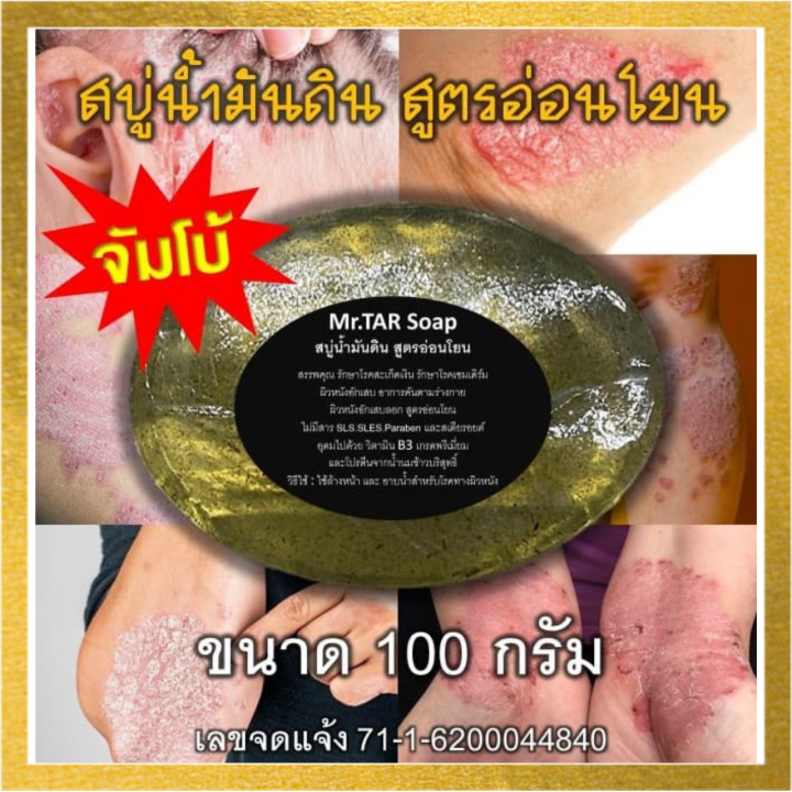 สบู่น้ำมันดินmr-tar-soap-สบู่น้ำมันดิน-100กรัม-สะเก็ดเงิน-เซบเดิร์ม-ผิวหนังอักเสบ-ผื่นคัน-ส่งด่วน