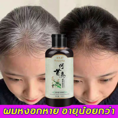 พร้อมส่ง🥇ANYICHUN🌈แชมพูปิดผมหงอก แชมพูแก้ผมหงอก แชมพูเหอโส่วอู 300ml แชมภูปิดผมขาว my organic แก้ผมหงอกถาวร แชมพูปิดหงอก ผมหงอกกลับมาดำ แก้ผมหงอก แชมพูสมุนไพร น้ำยาแก้ผมหงอก แชมพูผมดกดำ เซรั่มลดผมหงอก แชมพูขิง แชมพูปิดผมขาว เซรั่มแก้ผมขาว แชมพูสระผม