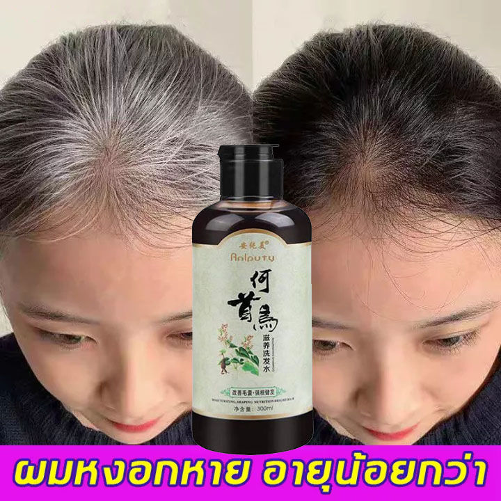 พร้อมส่ง-anyichun-แชมพูปิดผมหงอก-แชมพูแก้ผมหงอก-แชมพูเหอโส่วอู-300ml-แชมภูปิดผมขาว-my-organic-แก้ผมหงอกถาวร-แชมพูปิดหงอก-ผมหงอกกลับมาดำ-แก้ผมหงอก-แชมพูสมุนไพร-น้ำยาแก้ผมหงอก-แชมพูผมดกดำ-เซรั่มลดผมหงอก