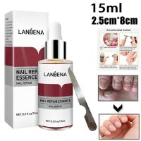 LANBENA Nail Repair Essence Serum Anti Fungal Repair Removal Infection Paronychia Onychomycosis Treatment Hand Foot Toe Care