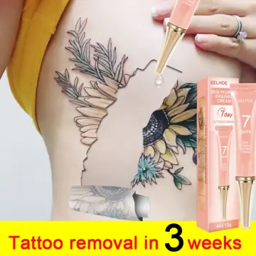 Do Tattoo Removal Creams Really Work? | Fresh Skin Canvas
