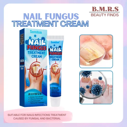 Authentic Nail Fungus Repair Treatment Cream Nail Care ointment Anti ...