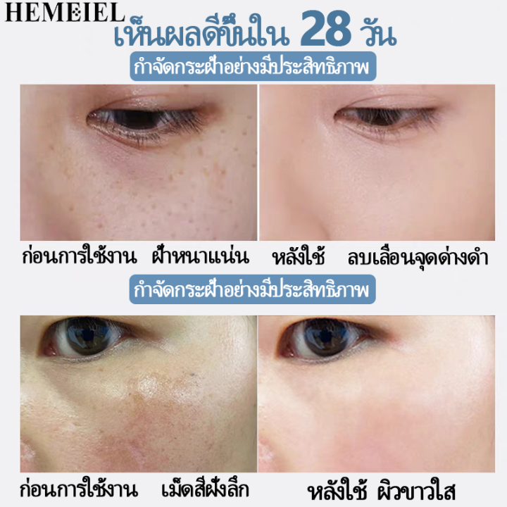 hemeiel-ครีมทาตัวขาวไว-โลชั่นผิวขาว-ครีมผิวขาวไว-100-ครีมผิวขาวในtitok-สดชื่นและให้ความชุ่มชื้นดูดซึมได้ง่าย