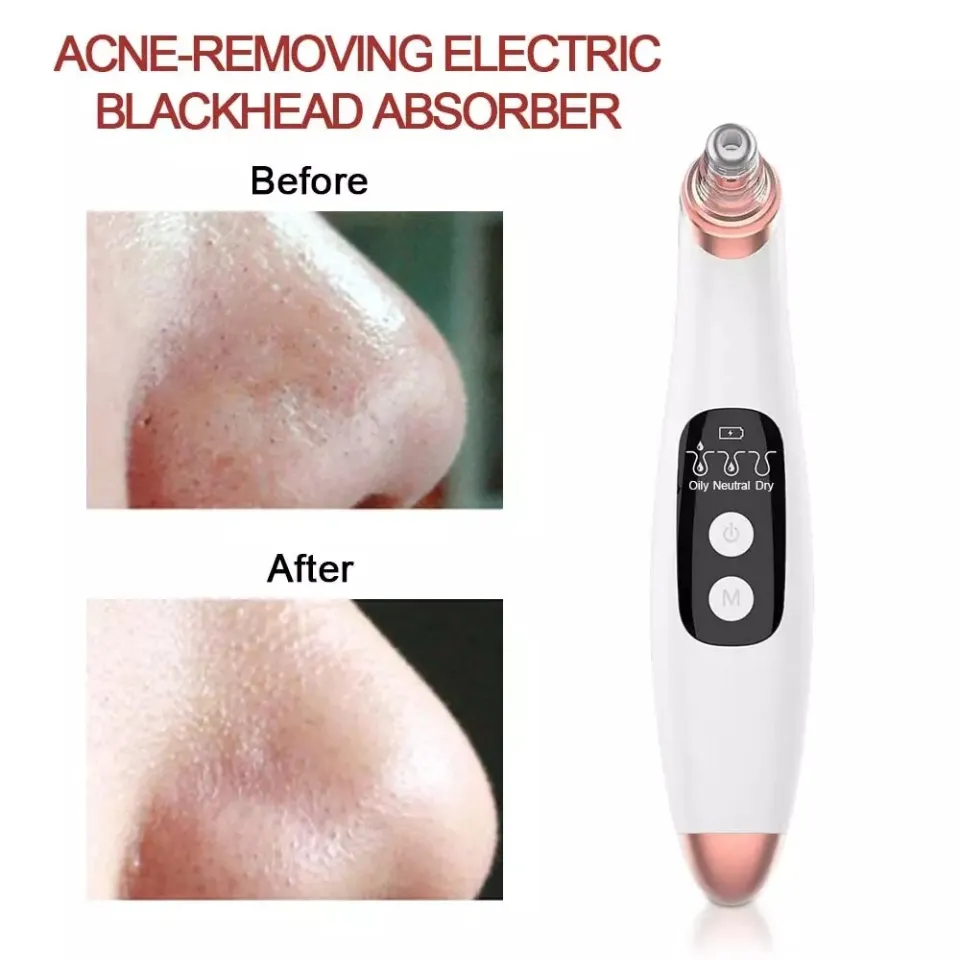 Blackhead Remover Faical Vacuum Cleaning T Zone Nose Pore Pimple Black Head  Point Bot Removal Cleaner Face Beauty Skin Care Tool