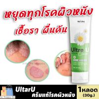 **ของแท้/พร้อมส่ง**[1หลอด] อัลตร้ายูครีม UltraU Cream ครีมแก้โรคผิวหนัง เชื้อรา ผื่นคัน กลาก เกลื้อน สะเก็ดเงิน Sohappy66