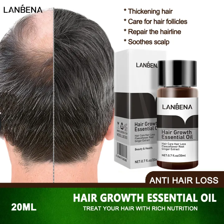 Amazing Lanbena Hair Growth Essential Oil Landscape Digital Art Amazing Lanbena Hair Growth Essential Oil Landscape Digital Art