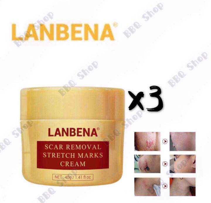 My capsule (3pcs) Original Lanbena Scar Removal Stretch Marks Cream 40g