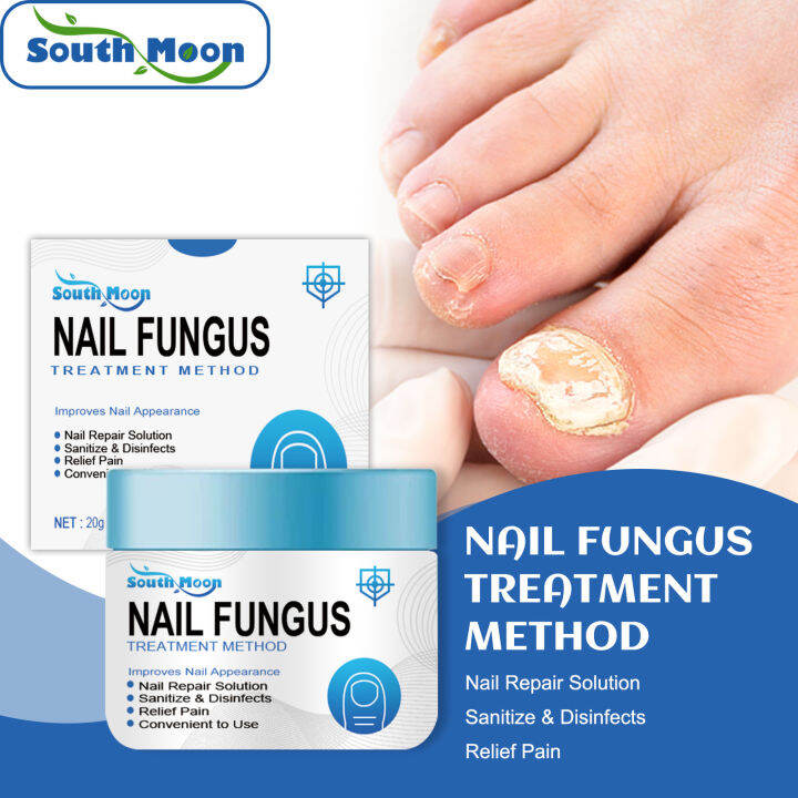 South Moon Nail Fungus Treatment Cream Anti Infection Cures