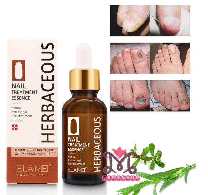 ELAIMEI NAIL TREATMENT ESSENCE 30ML Lazada