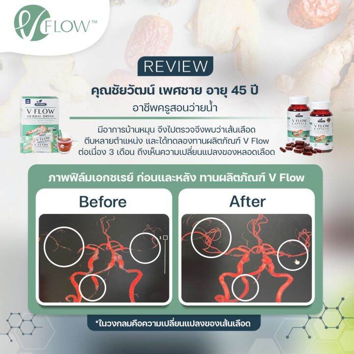 vflow-สารสกัด-สมุนไพร-ขิง-พุทราจีน-เห็ดหูหนูดำ-set-family