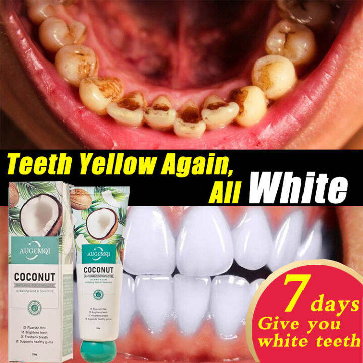 Whitening Toothpaste Activated Coconut Charcoal Toothpaste Hygiene