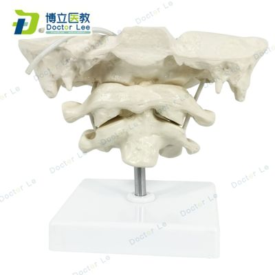 The occipital with atlas axis model simulation model of cervical vertebra bone specimen bonesetting can active the occipital model