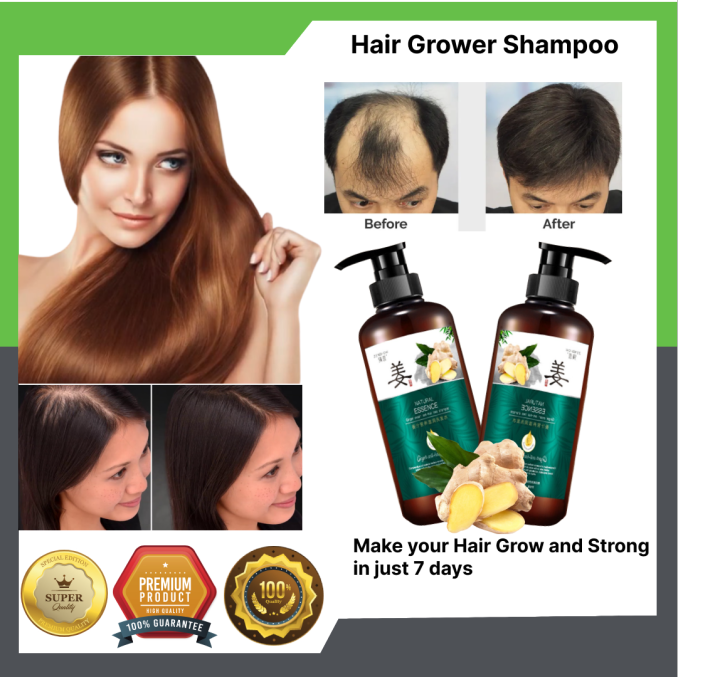 100% Original Organic Hair Growth Serum Ginger Hair Treatment Essence ...