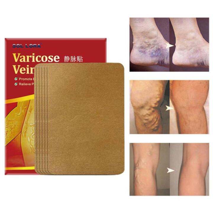 Spider Vein Patches 6 Patches Soothing Leg Patch For Spider Veins