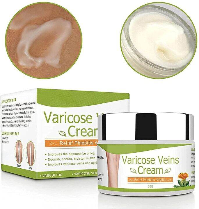 50g VeinEase Cream: Varicose Vein & Spider Vein Remover Effective ...