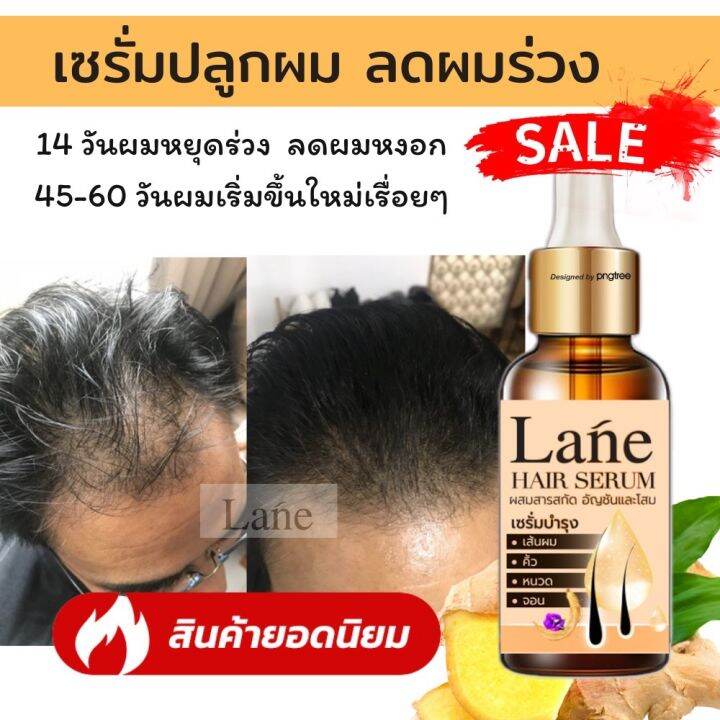 Lane เซรั่มปลูกผม ยาปลูกผม รักษาผมบาง ช่วยลดผมร่วง ช่วยหงอก สูตรสมุนไพรโสม ขิง อัญชัน Hair