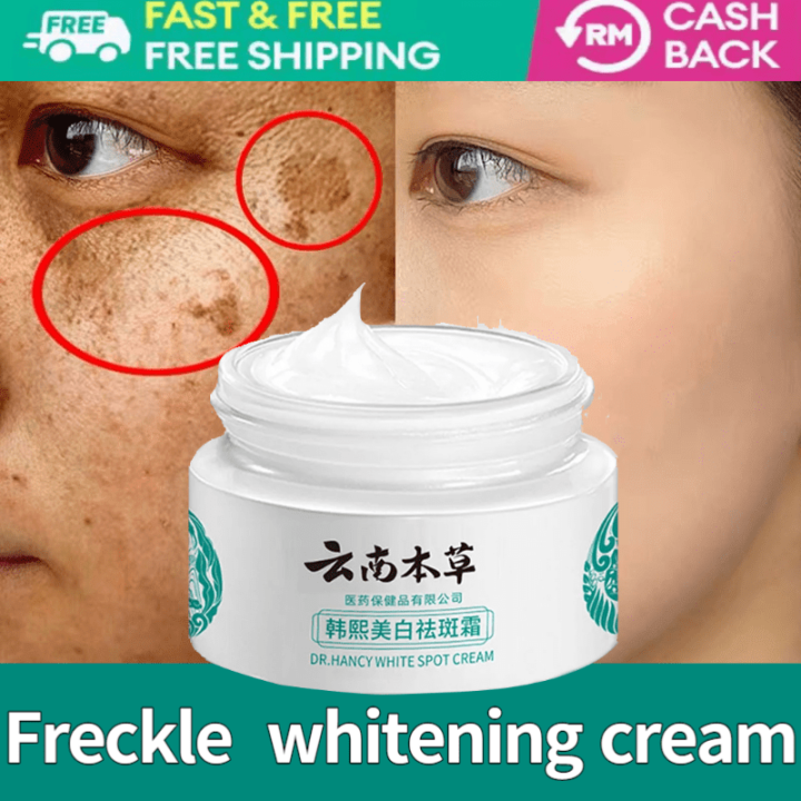 Yunnan Herbal Whitening Freckle Cream Melasma Removal Original Cream