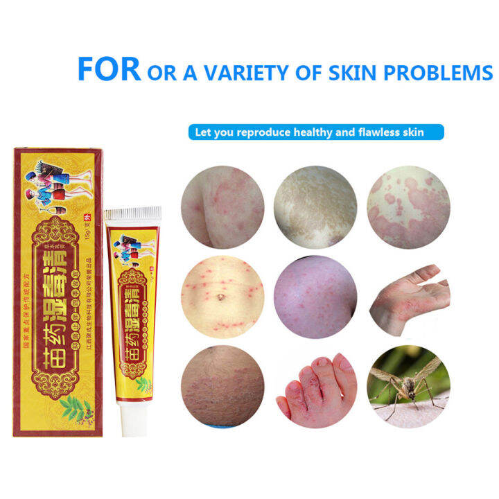 15g Fungus Anti Bacterial Cream Natural Chinese Herbs Cream Medicine ...