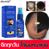 EELHOE hair regrowth spray, accelerating hair growth, accelerating hair growth, preventing hair loss, hair growth, regrowth hair, accelerating new hair growth Solve hair loss problems, reduce hair loss, hair conditioner, hair growth liquid, long hair acce