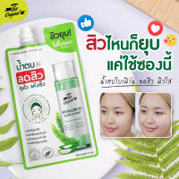 น้ำตบใบเฟิร์น น้ำตบลดสิว The Original Hyaluron Acne Expert