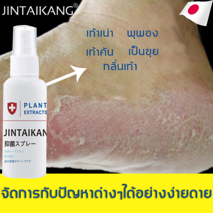 jintaikang-สเปรย์ดับกลิ่น-เท้าสเปรย์ฉีดดับ-กลิ่น-เท้า-สเปรย์รองเท้า-ขนาด-30ml-สเปรย์ดับกลิ่นเท้า-ดับกลิ่นไม่พึงประสงค์-ที่ดับกลิ่นรองเท้า