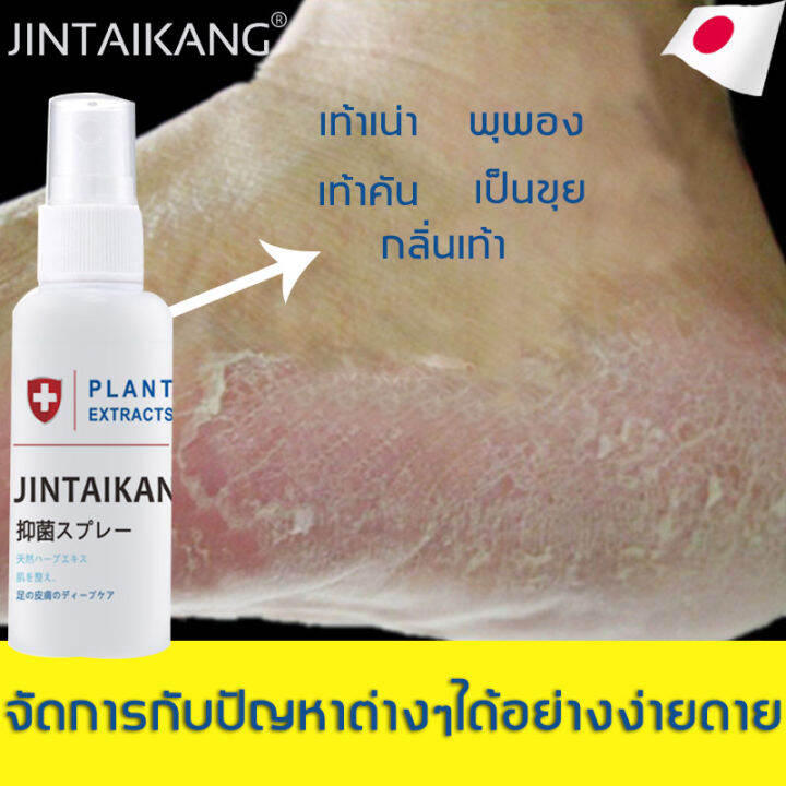 jintaikang-สเปรย์ดับกลิ่นเท้า-ดับกลิ่นไม่พึงประสงค์-ที่ดับกลิ่นรองเท้า-สเปรย์ดับเท้า-สเปรย์ฉีดดับ-กลิ่น-เท้า-สเปรย์รองเท้า-ขนาด-30ml