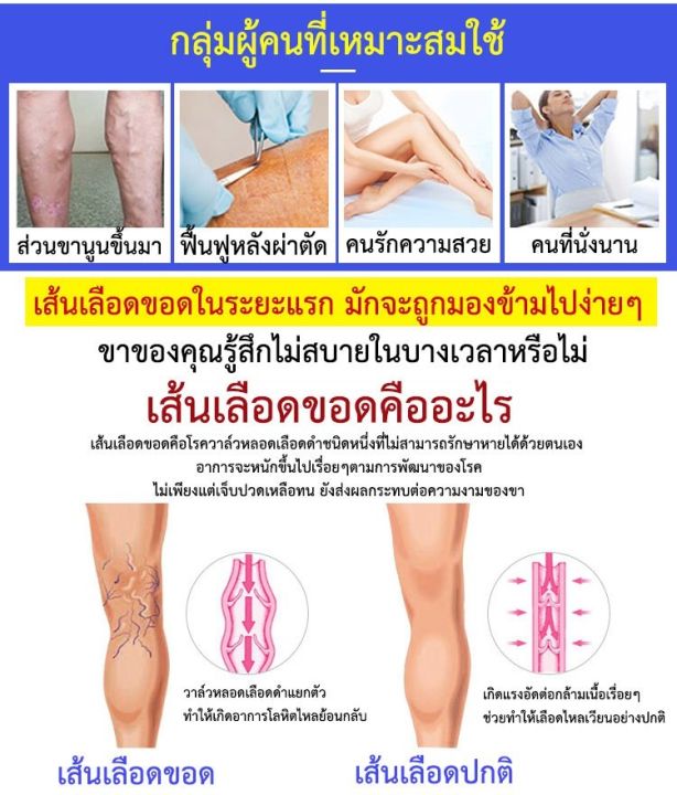 juscomart-ถุงเท้าสำหรับคนเส้นเลือดขอด