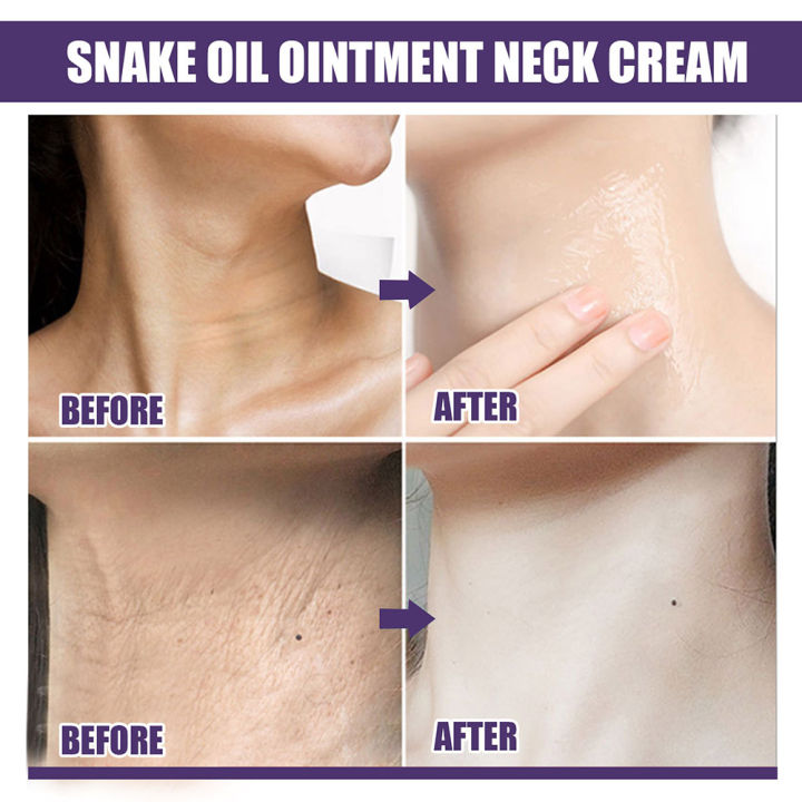 we-snake-oil-ointment-ครีมทาคอ-lighten-neck-fine-lines-wrinkle-remover-whitening-firming-cream-skin-care-product