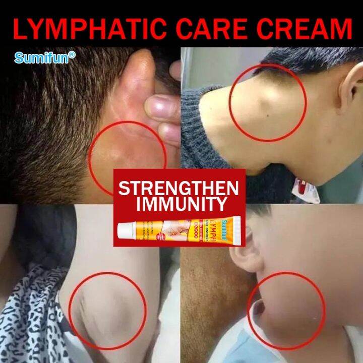 Lymphatic Detox ointment Hot neck swelling Axillary Node Breast Pain