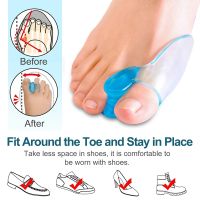 ☊ 2Pcs Silicone Gel Thumb Corrector Bunion Little Toe Protector Separator Hallux Valgus Finger Straightener Foot Care Relief Pads