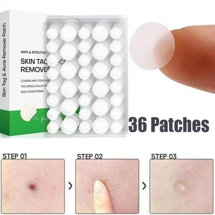 36pcs Skin Tag Remover Patch Pimple Wart Treatment Cream Quick Absorb Plaster Acne Anti 5799