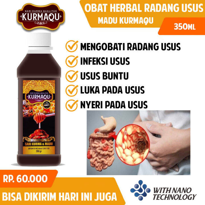 Obat Radang Usus Infeksi Usus Nyeri Usus Obat Usus Luka Sari Kurma