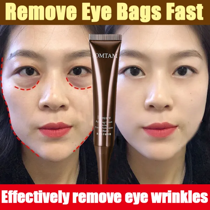 Eye Cream wrinkle eye cream eye bag remover cream original eyebag and