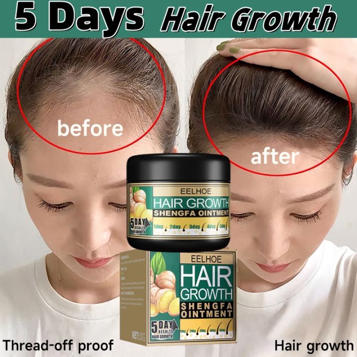 5 Days Hair Growth Cream 30g Ginger Hair Fast Regrowth Ointment Effect Prevents Hair Loss 2862