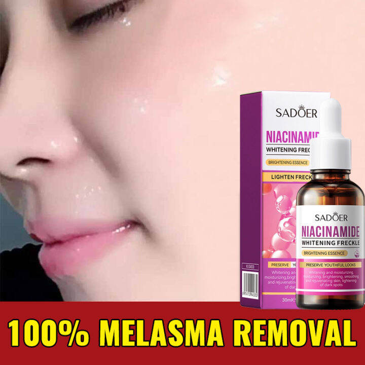 Melasma Whitening Serum Melasma Essence Oil Dark Spot Removal Brighten ...