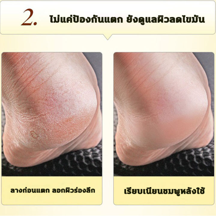 aichun-ครีมทาส้นทาแตก-100ml-ครีมทาเท้าแตก-เหมาะสำหรับส้นเท้าแตก-ผิวแตก-บำรุงผิว-ครีมทาส้นเท้าแตก-ซ่อมแซมผิวหนังแตก-ทาผิวเท้าแตก-ครีมส้นเท้าแตก-ครีมทาส้นเท้า-ครีมทาเท้า-ส้นเท้าแตก-ดูแลเท้า-foot-cream