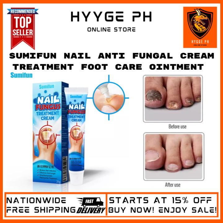 Sumifun Nail Fungus Repair Treatment Foot Care Ointment Anti Fungal ...