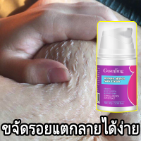 ครีมทาก้น 60g ลดรอยแตกลาย สูตรพิเศษ ครีมลดรอยแตกลาย