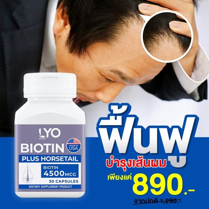 lyo-biotin-ไลโอ-ไบโอติน-วิตามินบำรุงเส้นผมชนิดรับประทาน-ลดผมร่วง-ชลอผมหงอก-เพิ่มผมใหม่-โดยหนุ่ม-กรรชัย-ส่งฟรี